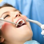 quy trinh boc rang su 2 1