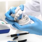 quy trinh boc rang su 4 1