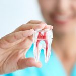 quy trinh boc rang su 5 1