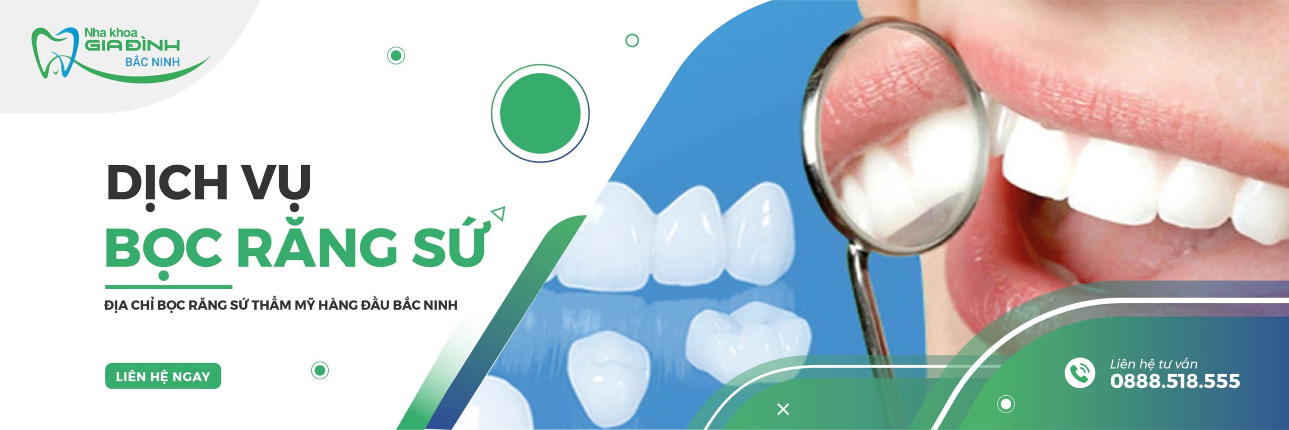 dich vu boc rang su nha khoa gia dinh bac ninh uy tin