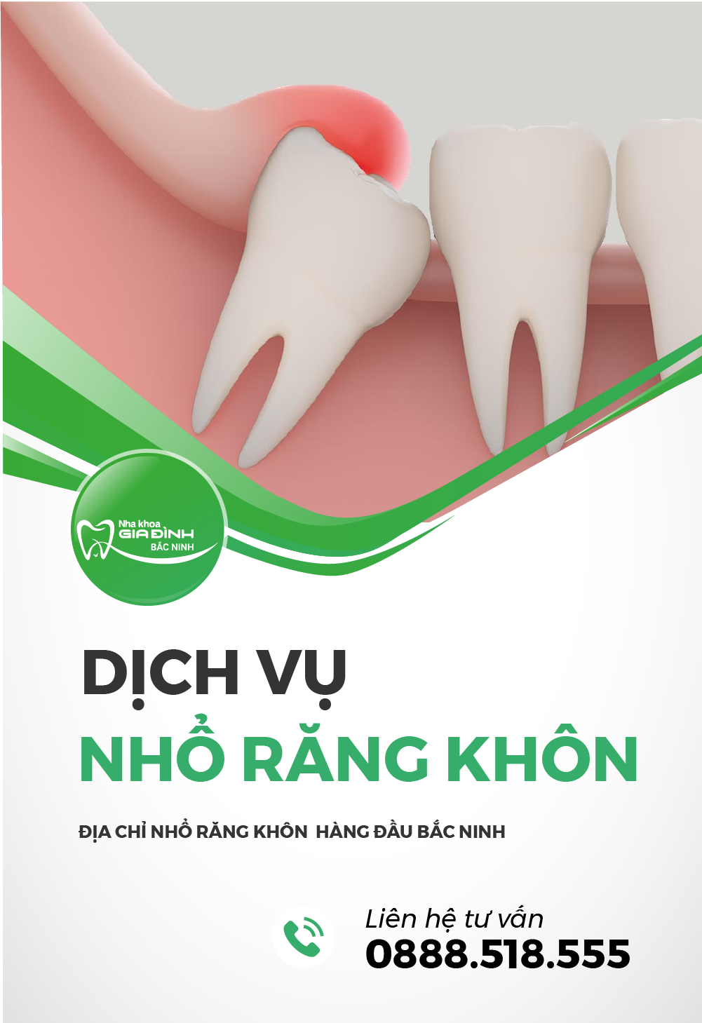 dich vu nho rang khon tai nha khoa gia dinh bac ninh khong dau