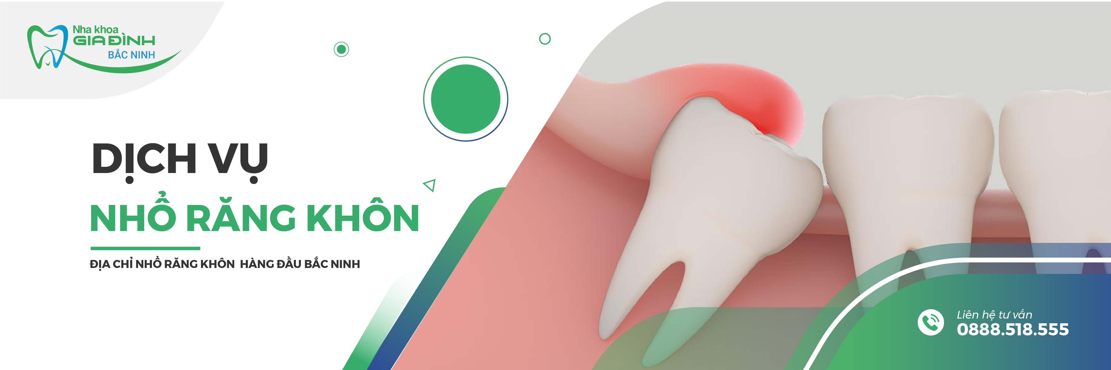 dich vu nho rang khon tai nha khoa gia dinh bac ninh uy tin