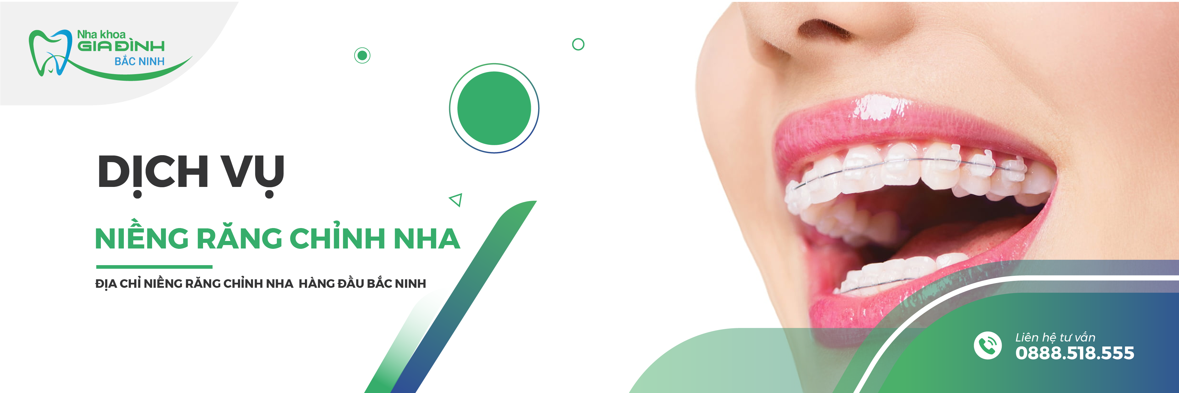 dich vu nieng rang chinh nha tai bac ninh - nha khoa gia dinh bac ninh uy tin-07