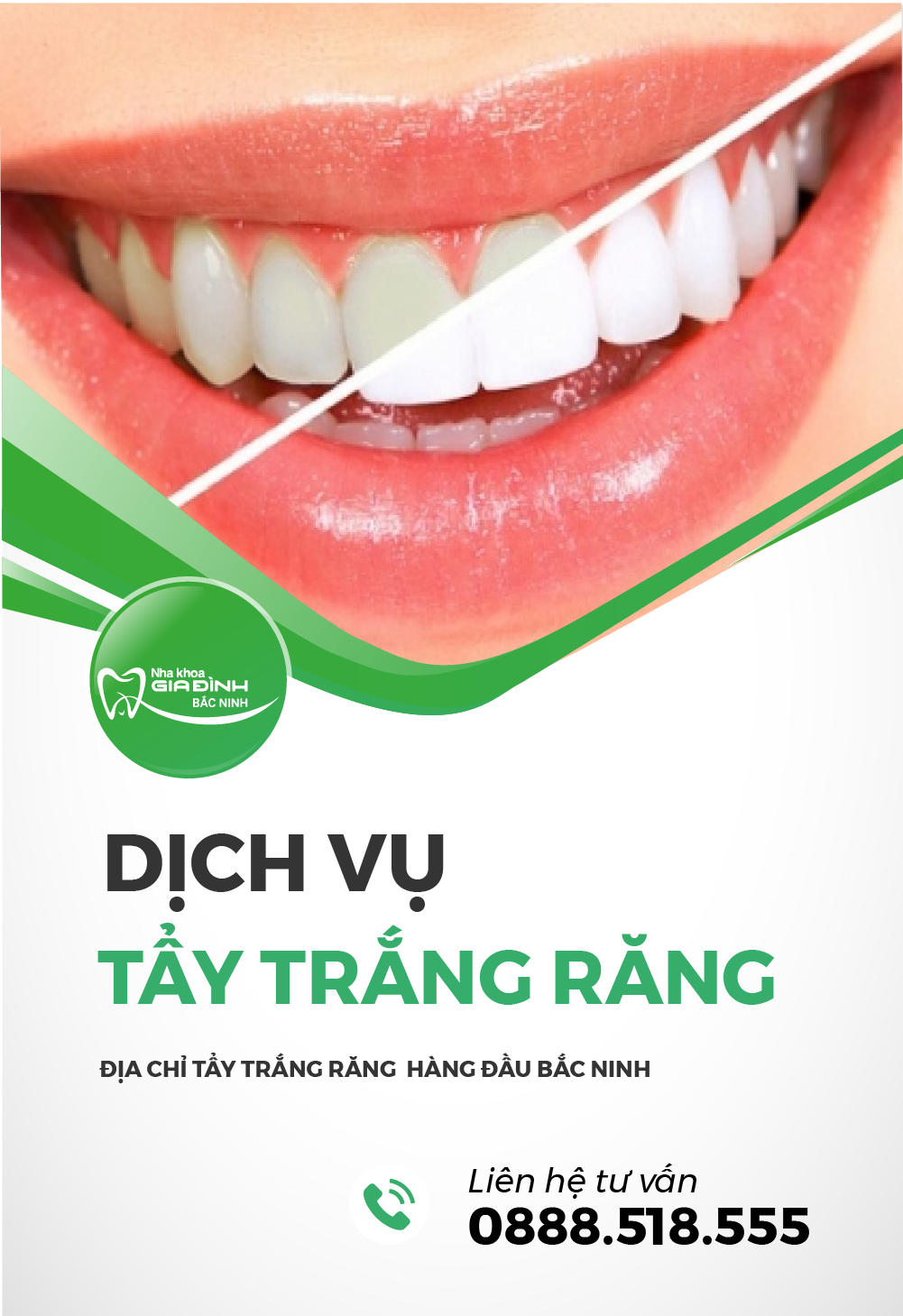 dich vu tay trang rang tai nha khoa gia dinh bac ninh uy tin