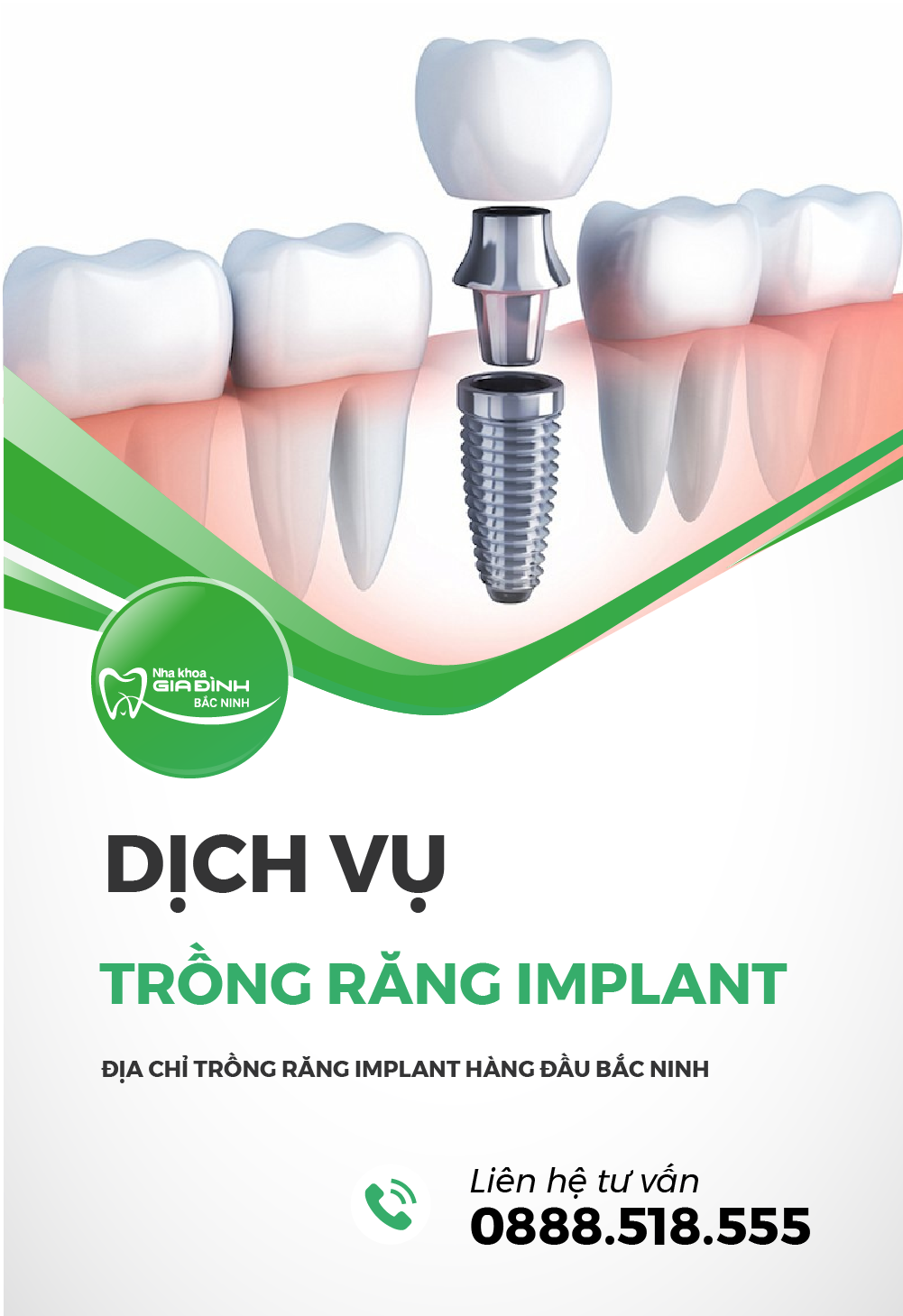 dich vu trong rang implant tai nha khoa gia dinh bac ninh gia re