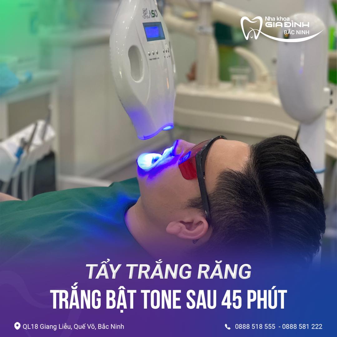 tay trang rang hieu qua sau 45 phut tai nha khoa gia dinh bac ninh