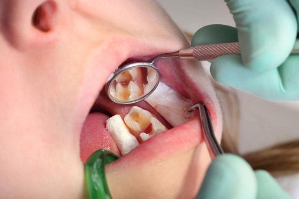 Đâu là đơn vị điều trị tủy răng tại Quế Võ chất lượng nhất? 1 Chọn Nha Khoa Gia Đình Bắc Ninh là đơn vị điều trị tủy răng tại Quế Võ