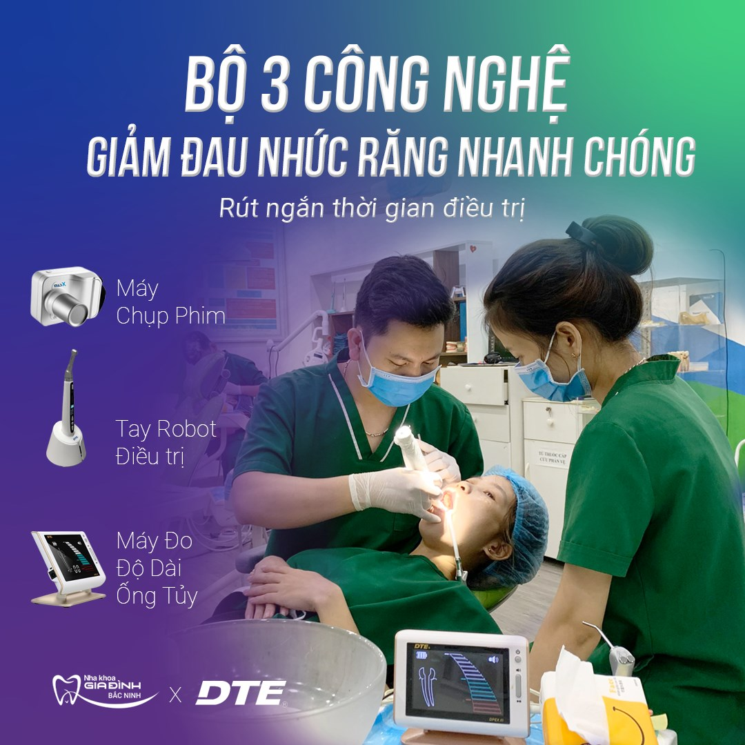 Địa chỉ điều trị tuỷ răng tại Tiên Du, Bắc Ninh an toàn, giá rẻ 4 Điều trị tủy hiệu quả, mức giá thành hợp lý