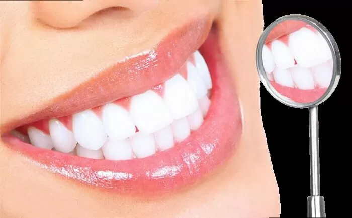 Địa chỉ tẩy trắng răng tại Quế Võ, Bắc Ninh uy tín nhất 1 Dịch vụ tẩy trắng răng tại Quế Võ