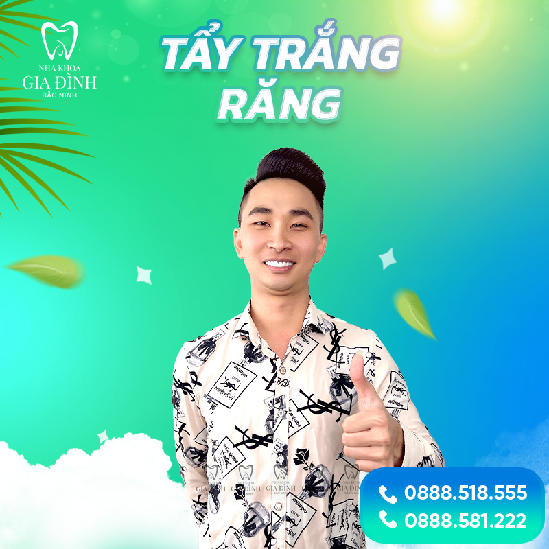 Địa chỉ tẩy trắng răng tại Tiên Du chuyên nghiệp hàng đầu 4 Nha Khoa Gia Đình luôn áp dụng giá thành hợp lý nhất cho tất cả mọi người