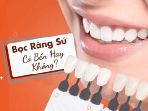 Bọc răng sứ có bền không phụ thuộc nhiều yếu tố