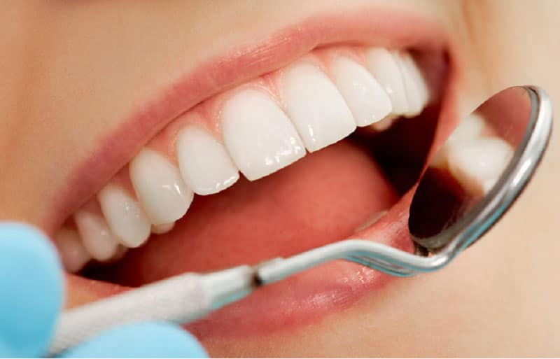 Có nên bọc răng sứ nguyên hàm không? Ưu và nhược điểm 4 Bọc răng sứ nguyên hàm cũng có những ưu điểm và hạn chế