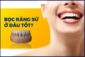 Nên đi bọc răng sứ ở đâu thì đẹp và an toàn