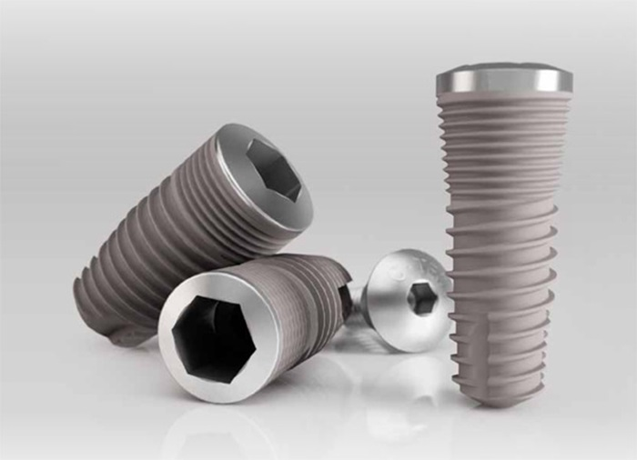 Giá trồng răng Implant Hàn Quốc có cao như lời đồn? 3 Giá trồng răng Implant Hàn Quốc cực rẻ