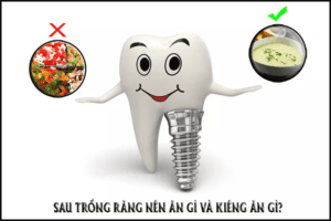 Trồng răng implant ăn gì mau lành thương?