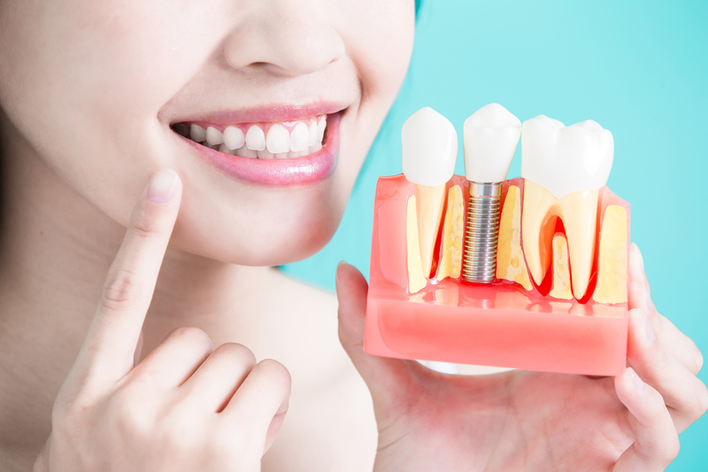 Giải đáp thắc mắc: Trồng răng implant bao lâu thì lành? 1 Trồng răng implant là gì?