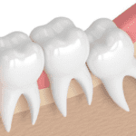 a gia nho rang khon tai bac ninh 1