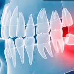 a gia nho rang khon tai bac ninh 2