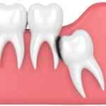 a gia nho rang khon tai bac ninh 3