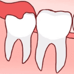 a gia nho rang khon tai bac ninh 6