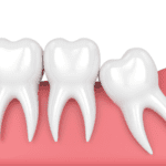 a gia nho rang khon tai bac ninh 7