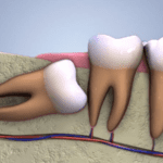 a gia nho rang khon tai bac ninh 9