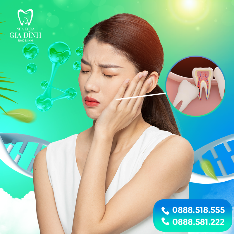 Nhổ răng khôn bao lâu thì lành? Cần lưu ý thêm điều gì? 1 nho rang khon bao lau thi lanh