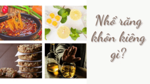 Nhổ răng khôn kiêng gì tốt