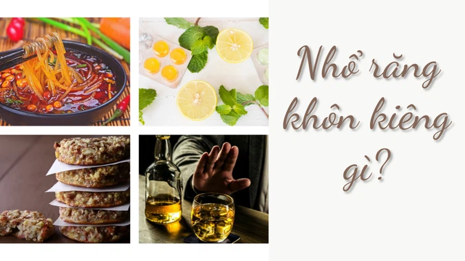 Nhổ răng khôn kiêng gì để nhanh chóng lành vết thương 1 Nhổ răng khôn kiêng gì tốt
