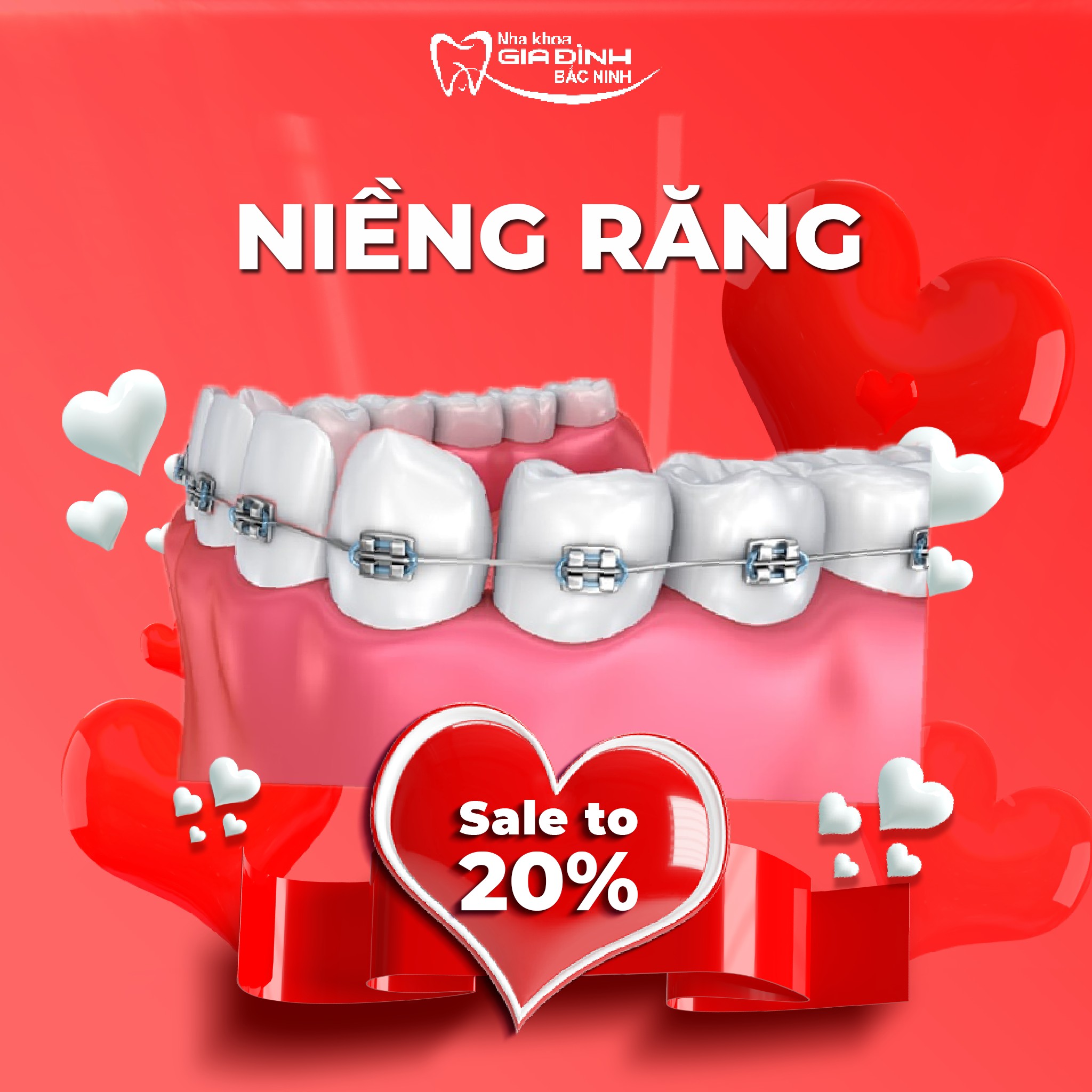 nha khoa gia đình Bắc ninh giảm giá đến 20% niềng răng ngày Valentine 2023