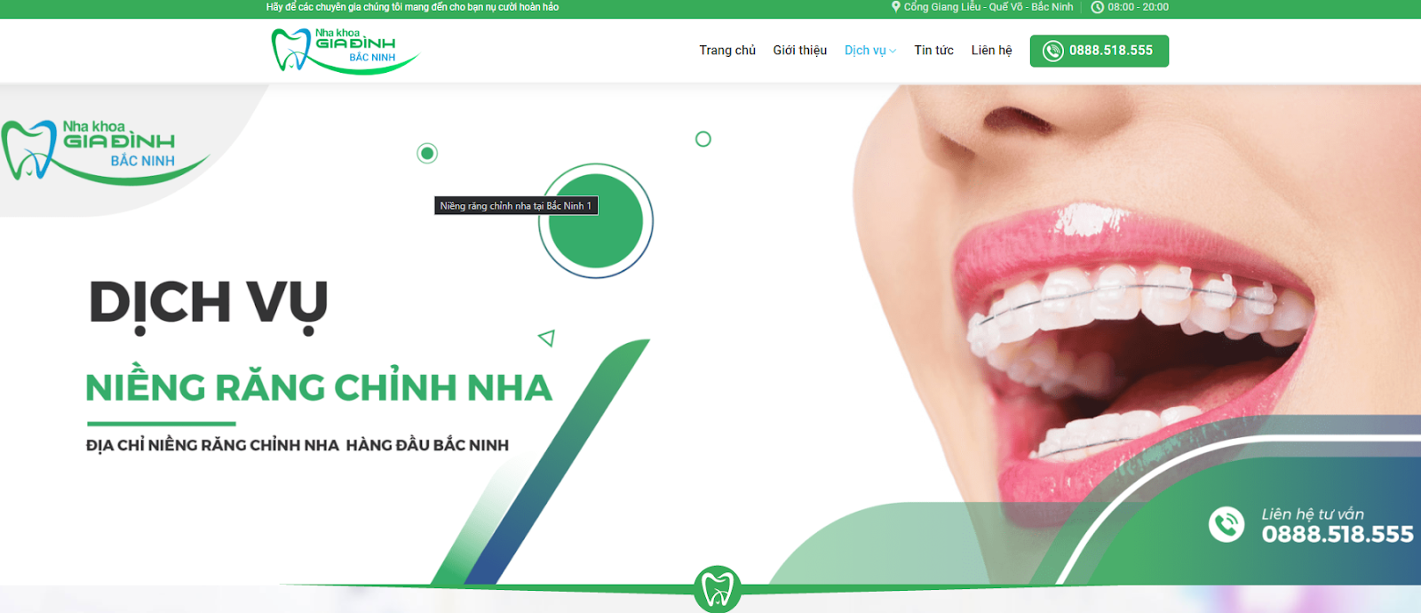 Dịch vụ niềng răng trả góp chất lượng tại Bắc Ninh 1 Niềng răng trả góp tại Phòng khám nha khoa gia đình Bắc Ninh