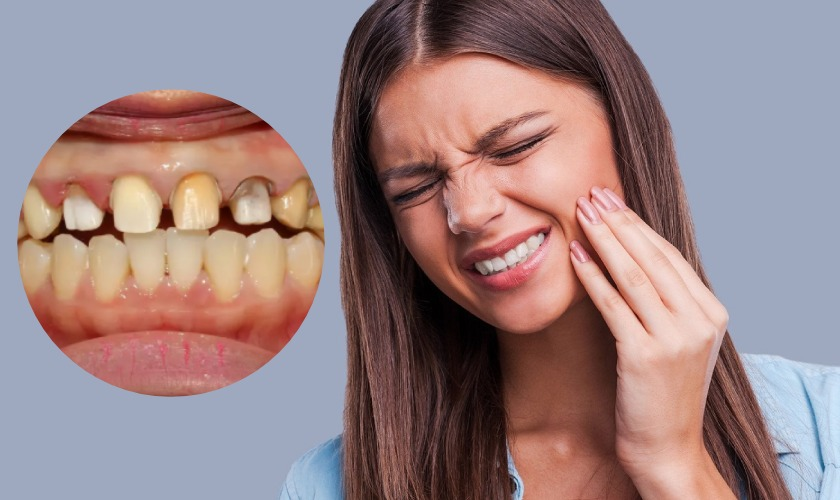 Hỏi đáp - Ở đâu niềng răng tốt Bắc Ninh 2 Hậu quả khôn lường của việc niềng răng kém chất lượng
