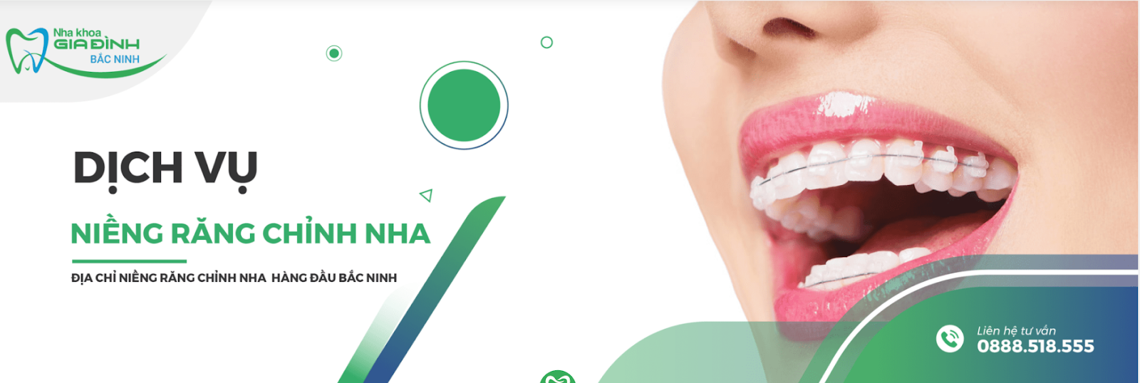 Hỏi đáp - Ở đâu niềng răng tốt Bắc Ninh 3 Ở đâu niềng răng tốt Bắc Ninh? - Nha khoa gia đình Bắc Ninh luôn là địa chỉ niềng răng hàng đầu