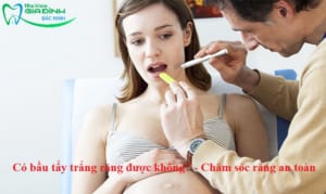 Có bầu tẩy trắng răng được không? - Chăm sóc răng an toàn