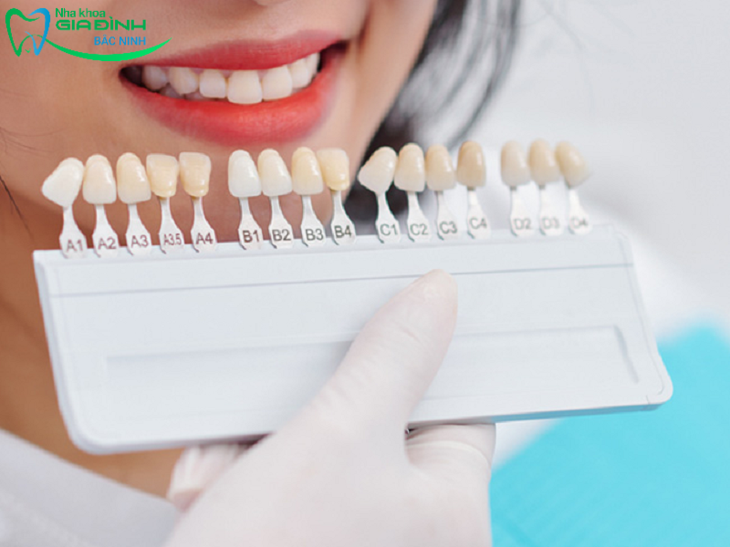  Vệ sinh răng miệng và đo màu sắc răng