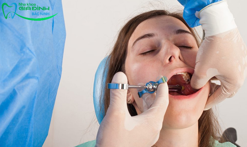 Cách ly lợi và tiêm thuốc chống ê buốt