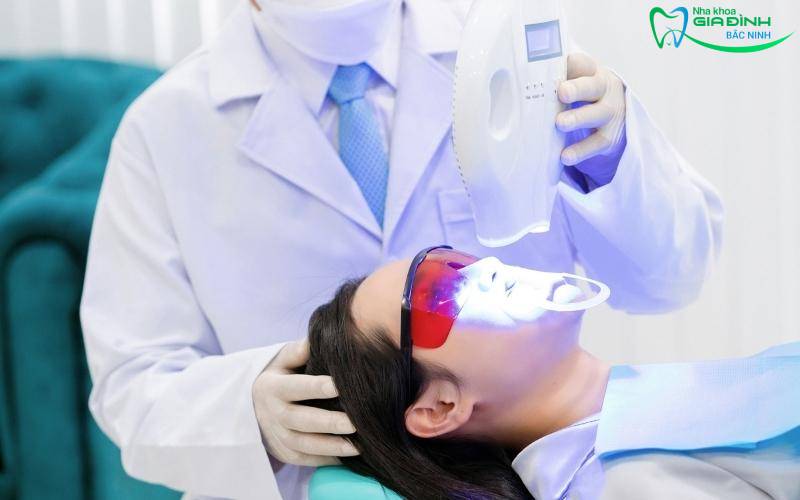 Các công nghệ tẩy răng nha khoa phổ biến hiện nay 3 Công nghệ tẩy răng nha khoa Nano S-White