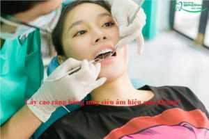 Lấy cao răng bằng máy siêu âm hiệu quả không? 