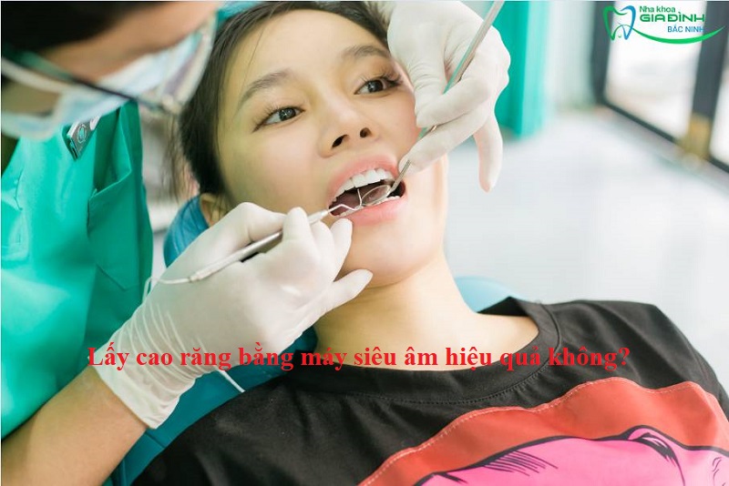Hỏi đáp nhanh: Lấy cao răng bằng máy siêu âm hiệu quả không? 11 Lấy cao răng bằng máy siêu âm hiệu quả không?