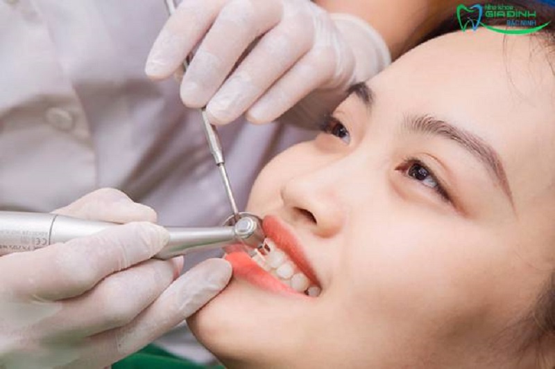 Tìm hiểu quy trình tẩy trắng răng nha khoa chuẩn nhất 2 Khách hàng sẽ được dẫn đi khám tổng quát để nắm rõ tình trạng răng miệng