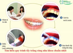 Tìm hiểu quy trình tẩy trắng răng nha khoa chuẩn nhất 