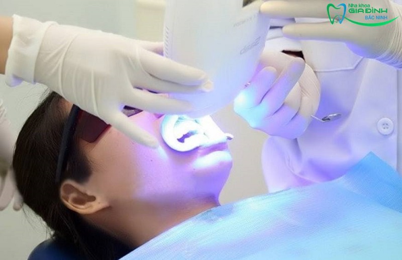 Hỏi đáp nhanh: Khi nào nên tẩy và không nên tẩy răng nha khoa? 3 Dù tẩy trắng đã ứng dụng công nghệ hiện đại nhưng vẫn xảy ra một vài tác dụng phụ ở khách hàng có răng nhạy cảm