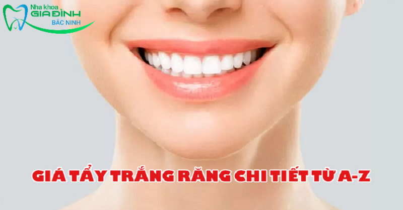 Tẩy trắng răng bao nhiêu tiền - Cập nhật giá mới nhất 2024 3 tay trang rang bao nhieu tien 2