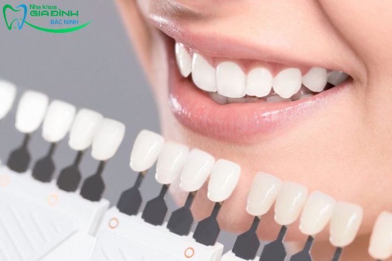 Tẩy trắng răng có đau không? Nguyên nhân gây đau nhức răng khi tẩy trắng 2 Cơ chế tẩy trắng răng hiện nay