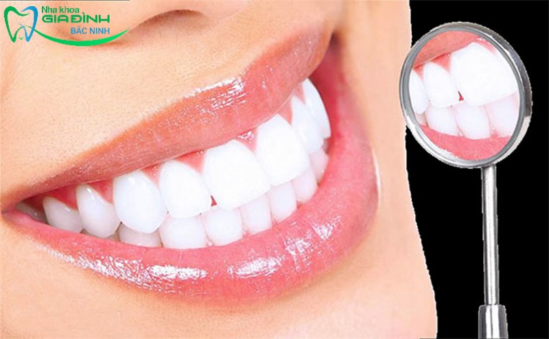 Tẩy trắng răng có đau không? Nguyên nhân gây đau nhức răng khi tẩy trắng 4 Khắc phục tình trạng đau răng khi tẩy trắng