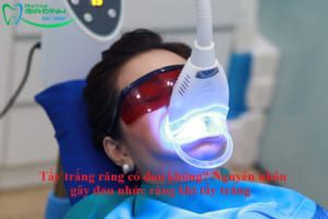 Tẩy trắng răng có đau không? Nguyên nhân gây đau nhức răng khi tẩy trắng