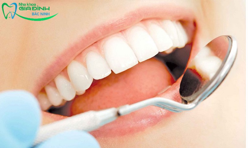Tẩy trắng răng có hại không, có ảnh hưởng đến sức khỏe? 4 Lời khuyên sau khi sử dụng dịch vụ tẩy trắng răng tại nha khoa là gì?