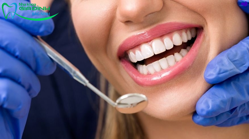 Tẩy trắng răng có tốt không? Phương pháp tẩy trắng răng tốt 2 Phương pháp tẩy trắng răng có tốt không?