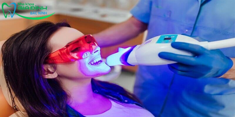 Chi phí tẩy trắng răng giá bao nhiêu 2024? 4 Phương pháp sử dụng tia Laser Whitening để tẩy trắng răng