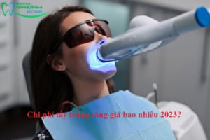 Chi phí tẩy trắng răng giá bao nhiêu 2023?